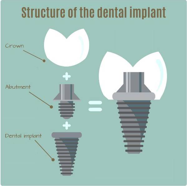 temporary dental glue for crowns