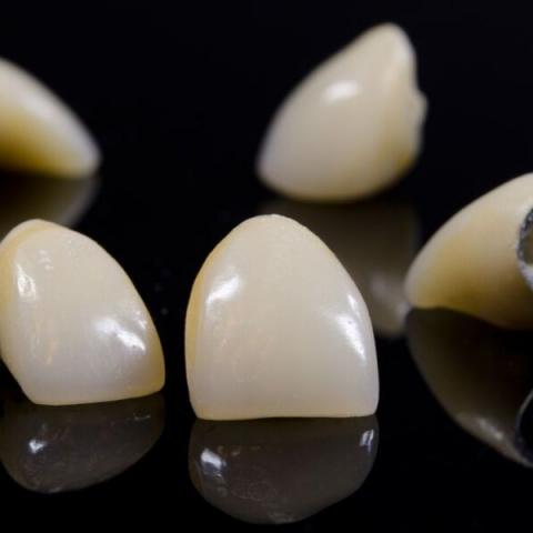 dental crowns for front teeth