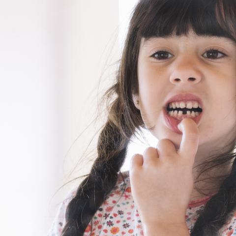 ¿Qué tan fuertes son las coronas de los dientes frontales?