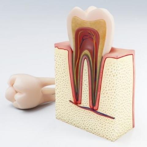 Root Canal Treatments and Dental Crowns