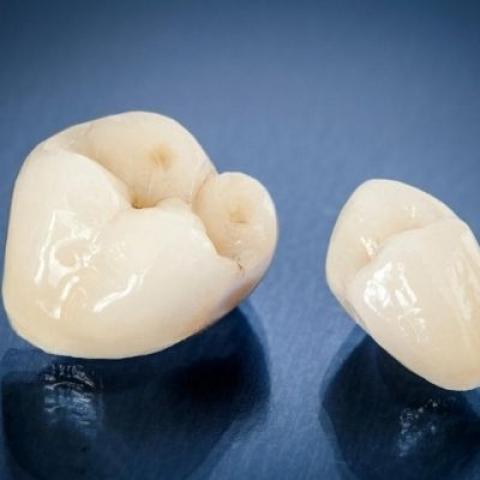 zirconia dental crown