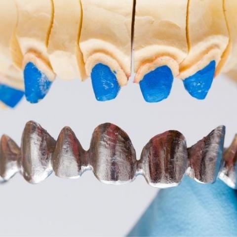 Stainless steel crown for pediatric dentistry
