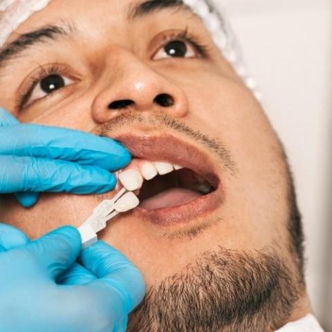 Cost of Zirconia Dental Crown