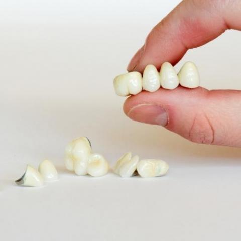 Zirconia tooth Crown