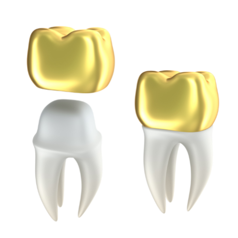 Stainless steel Crown tooth