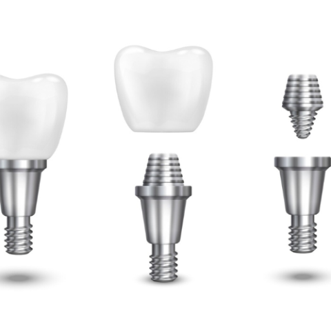 anterior stainless steel crown